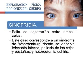 SINOFRIDIA.
• Falta de separación entre ambas
cejas.
• Este caso corresponde a un síndrome
de Waardenburg donde se observa
telecanto interno, poliosis de las cejas
y pestañas, y heterocromia del iris.
EXPLORACIÓN FÍSICA POR SEGMENTOS O
REGIONES DEL CUERPO
 