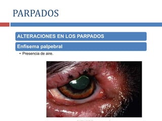ALTERACIONES EN LOS PARPADOS
Enfisema palpebral
• Presencia de aire.
PARPADOS
 