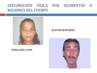 PARALISIS III PAR
BLEFAROESPASMO
EXPLORACIÓN FÍSICA POR SEGMENTOS O
REGIONES DEL CUERPO
 