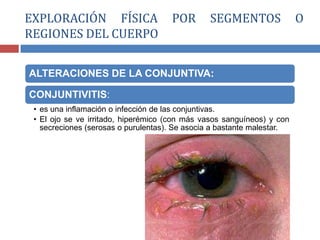 ALTERACIONES DE LA CONJUNTIVA:
CONJUNTIVITIS:
• es una inflamación o infección de las conjuntivas.
• El ojo se ve irritado, hiperémico (con más vasos sanguíneos) y con
secreciones (serosas o purulentas). Se asocia a bastante malestar.
EXPLORACIÓN FÍSICA POR SEGMENTOS O
REGIONES DEL CUERPO
 