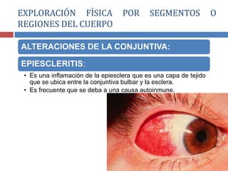 ALTERACIONES DE LA CONJUNTIVA:
EPIESCLERITIS:
• Es una inflamación de la epiesclera que es una capa de tejido
que se ubica entre la conjuntiva bulbar y la esclera.
• Es frecuente que se deba a una causa autoinmune.
EXPLORACIÓN FÍSICA POR SEGMENTOS O
REGIONES DEL CUERPO
 