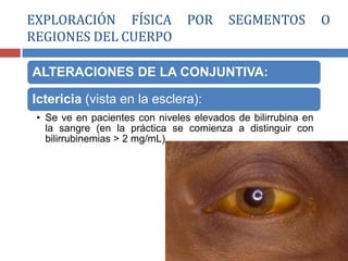 ALTERACIONES DE LA CONJUNTIVA:
Ictericia (vista en la esclera):
• Se ve en pacientes con niveles elevados de bilirrubina en
la sangre (en la práctica se comienza a distinguir con
bilirrubinemias > 2 mg/mL).
EXPLORACIÓN FÍSICA POR SEGMENTOS O
REGIONES DEL CUERPO
 