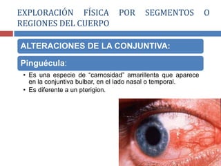 ALTERACIONES DE LA CONJUNTIVA:
Pinguécula:
• Es una especie de “carnosidad” amarillenta que aparece
en la conjuntiva bulbar, en el lado nasal o temporal.
• Es diferente a un pterigion.
EXPLORACIÓN FÍSICA POR SEGMENTOS O
REGIONES DEL CUERPO
 