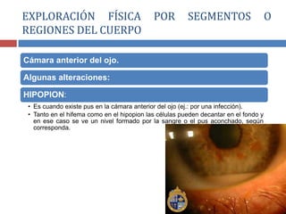 Cámara anterior del ojo.
Algunas alteraciones:
HIPOPION:
• Es cuando existe pus en la cámara anterior del ojo (ej.: por una infección).
• Tanto en el hifema como en el hipopion las células pueden decantar en el fondo y
en ese caso se ve un nivel formado por la sangre o el pus aconchado, según
corresponda.
EXPLORACIÓN FÍSICA POR SEGMENTOS O
REGIONES DEL CUERPO
 