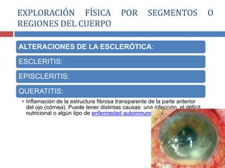 ALTERACIONES DE LA ESCLERÓTICA:
ESCLERITIS:
EPISCLERITIS:
QUERATITIS:
• Inflamación de la estructura fibrosa transparente de la parte anterior
del ojo (córnea). Puede tener distintas causas: una infección, el déficit
nutricional o algún tipo de enfermedad autoinmune.
EXPLORACIÓN FÍSICA POR SEGMENTOS O
REGIONES DEL CUERPO
 