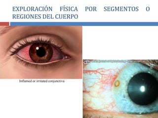 EXPLORACIÓN FÍSICA POR SEGMENTOS O
REGIONES DEL CUERPO
 