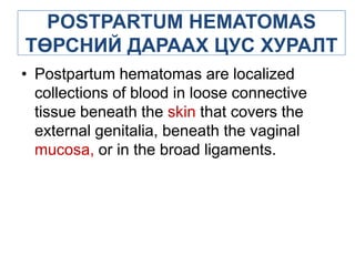 POSTPARTUM HEMATOMAS
ТӨРСНИЙ ДАРААХ ЦУС ХУРАЛТ
• Postpartum hematomas are localized
collections of blood in loose connective
tissue beneath the skin that covers the
external genitalia, beneath the vaginal
mucosa, or in the broad ligaments.

 