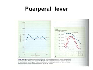 Puerperal fever

 