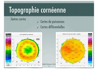 Topographie cornéenne
Autres cartes

✔
✔

Cartes de puissances
Cartes différentielles

J-A.DOUAUD - ISO Bordeaux - 2013/2014

11

 