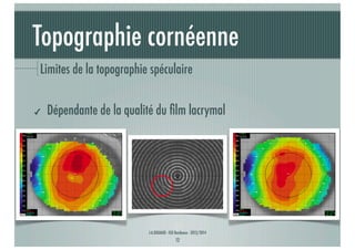 Topographie cornéenne
Limites de la topographie spéculaire
✔

Dépendante de la qualité du ﬁlm lacrymal

J-A.DOUAUD - ISO Bordeaux - 2013/2014

12

 