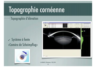 Topographie cornéenne
Topographie d'élévation

Système à fente
«Caméra de Scheimpﬂug»
✔

J-A.DOUAUD - ISO Bordeaux - 2013/2014

14

 