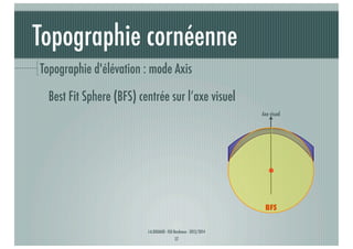 Topographie cornéenne
Topographie d'élévation : mode Axis
Best Fit Sphere (BFS) centrée sur l’axe visuel
Axe visuel

BFS
J-A.DOUAUD - ISO Bordeaux - 2013/2014

17

 