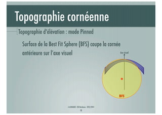 Topographie cornéenne
Topographie d'élévation : mode Pinned
Surface de la Best Fit Sphere (BFS) coupe la cornée
Axe visuel
antérieure sur l’axe visuel

BFS
J-A.DOUAUD - ISO Bordeaux - 2013/2014

18

 