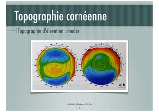 Topographie cornéenne
Topographie d'élévation : modes

J-A.DOUAUD - ISO Bordeaux - 2013/2014

22

 