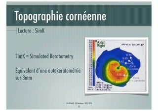Topographie cornéenne
Lecture : SimK

SimK = Simulated Keratometry
Équivalent d’une autokératométrie
sur 3mm

J-A.DOUAUD - ISO Bordeaux - 2013/2014

25

 