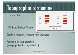 Topographie cornéenne
Lecture : ISV

ISV = Index Surface Variance
Courbure moyenne / moyenne des courbures
Augmente en cas d’asymétrie
(warepage, keratocone, ortho-K...)
J-A.DOUAUD - ISO Bordeaux - 2013/2014

26

 