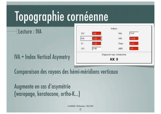 Topographie cornéenne
Lecture : IVA

IVA = Index Vertical Asymetry
Comparaison des rayons des hémi-méridiens verticaux
Augmente en cas d’asymétrie
(warepage, keratocone, ortho-K...)
J-A.DOUAUD - ISO Bordeaux - 2013/2014

27

 