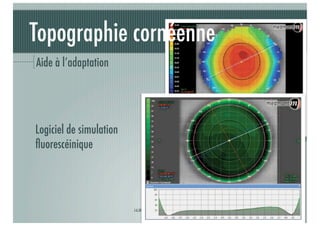 Topographie cornéenne
Aide à l’adaptation

Logiciel de simulation
ﬂuorescéinique

J-A.DOUAUD - ISO Bordeaux - 2013/2014

37

 