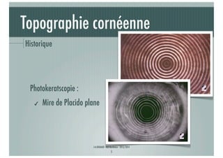 Topographie cornéenne
Historique

Photokeratscopie :
✔

Mire de Placido plane

J-A.DOUAUD - ISO Bordeaux - 2013/2014

5

 