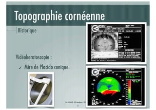 Topographie cornéenne
Historique

Vidéokeratoscopie :
✔

Mire de Placido conique

J-A.DOUAUD - ISO Bordeaux - 2013/2014

6

 