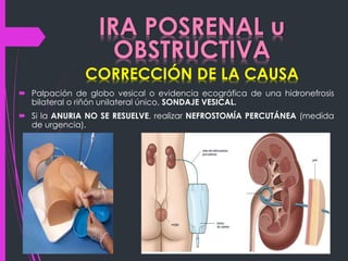 IRA POSRENAL u 
OBSTRUCTIVA 
CORRECCIÓN DE LA CAUSA 
 Palpación de globo vesical o evidencia ecográfica de una hidronefrosis 
bilateral o riñón unilateral único, SONDAJE VESICAL. 
 Si la ANURIA NO SE RESUELVE, realizar NEFROSTOMÍA PERCUTÁNEA (medida 
de urgencia). 
 