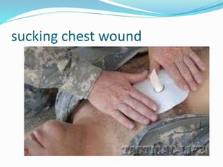 sucking chest wound
 