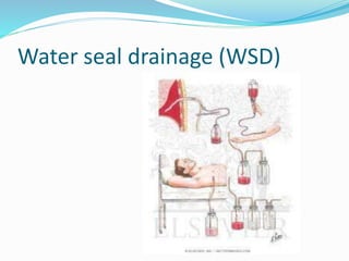 Water seal drainage (WSD)
 