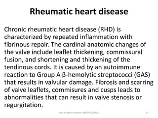 Rheumatic heart disease 
Chronic rheumatic heart disease (RHD) is 
characterized by repeated inflammation with 
fibrinous repair. The cardinal anatomic changes of 
the valve include leaflet thickening, commissural 
fusion, and shortening and thickening of the 
tendinous cords. It is caused by an autoimmune 
reaction to Group A β-hemolytic streptococci (GAS) 
that results in valvular damage. Fibrosis and scarring 
of valve leaflets, commisures and cusps leads to 
abnormalities that can result in valve stenosis or 
regurgitation. 
prof Ariyanto Harsono MD PhD SpA(K) 17 
 