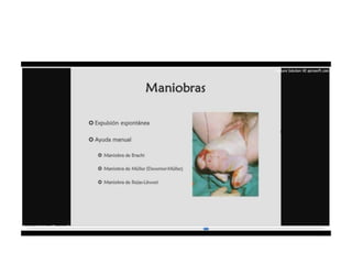 9.  presentacion podalica y transversa