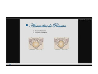 9.  presentacion podalica y transversa