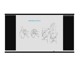 9.  presentacion podalica y transversa