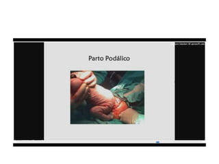 9.  presentacion podalica y transversa