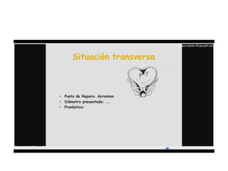 9.  presentacion podalica y transversa