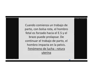 9.  presentacion podalica y transversa