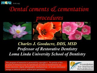 Dental cements & cementation
procedures
Charles J. Goodacre, DDS, MSD
Professor of Restorative Dentistry
Loma Linda University School of Dentistry
This program of instruction is protected by copyright ©. No portion of this
program of instruction may be reproduced, recorded or transferred by any
means electronic, digital, photographic, mechanical etc., or by any information
storage or retrieval system, without prior permission.
 