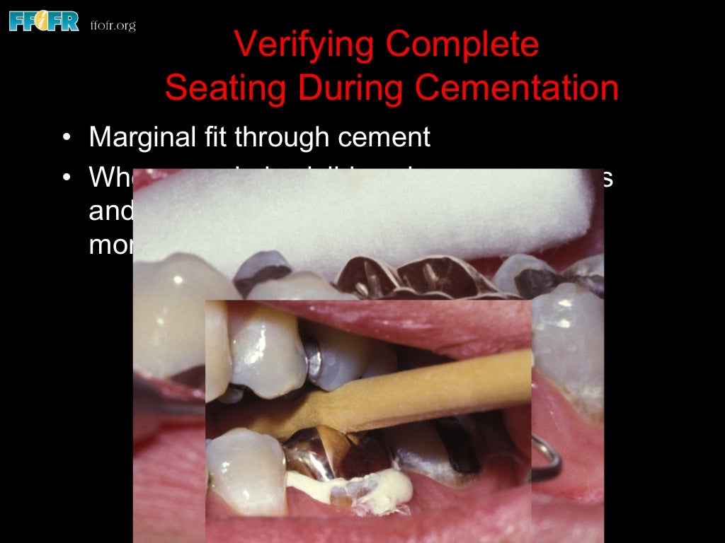 9.dental cements