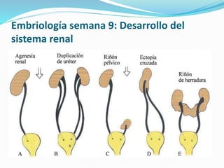 Embriología semana 9: Desarrollo del
sistema renal
 