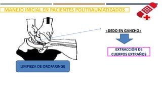 MANEJO INICIAL EN PACIENTES POLITRAUMATIZADOS
LIMPIEZA DE OROFARINGE
«DEDO EN GANCHO»
EXTRACCIÓN DE
CUERPOS EXTRAÑOS
 