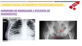 MANEJO INICIAL EN PACIENTES POLITRAUMATIZADOS
EXÁMENES DE RADIOLOGÍA Y ESTUDIOS DE
DIAGNÓSTICO
Usarse con prudencia.
 