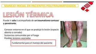 MANEJO INICIAL EN PACIENTES POLITRAUMATIZADOS
Puede ir sola ó acompañada de un traumatismo contuso
y penetrante.
Conocer entorno en el que se produjo la lesión (espacio
abierto o cerrado)
Sustancias consumidas por el fuego
Posibles lesiones asociadas
Fundamental para el manejo del paciente
 