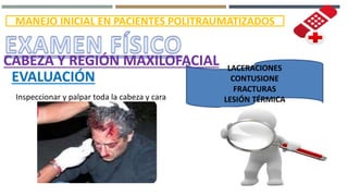 MANEJO INICIAL EN PACIENTES POLITRAUMATIZADOS
EVALUACIÓN
Inspeccionar y palpar toda la cabeza y cara
LACERACIONES
CONTUSIONE
FRACTURAS
LESIÓN TÉRMICA
CABEZA Y REGIÓN MAXILOFACIAL
 