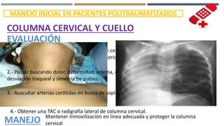 MANEJO INICIAL EN PACIENTES POLITRAUMATIZADOS
COLUMNA CERVICAL Y CUELLO
EVALUACIÓN
1.- Inspección buscando signos de una lesión cerrada o penetrante,
desviación traqueal y uso de músculos accesorios para la respiración.
2.- Palpar buscando dolor, deformidad, edema, enfisema subcutáneo,
desviación traqueal y simetría de pulsos.
3.- Auscultar arterias carótidas en busca de soplos.
4.- Obtener una TAC o radigrafía lateral de columna cervical.
MANEJO Mantener inmovilización en línea adecuada y proteger la columna
cervical
 