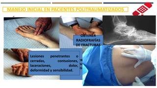 MANEJO INICIAL EN PACIENTES POLITRAUMATIZADOS
MÚSCULO ESQUELÉTICO
EVALUACIÓN
1.- Inspeccionar extremidades superiores e inferiores
2.- Palpación de extremidades
3.- Palpación de pulsos periféricos
4.- Revisar pelvis
5.- Inspeccionar y palpar columna torácica y lumbar
Buscar lesiones cerradas o
penetrantes, contusiones,
laceraciones y
deformidades.
Dolor,crepitación,
movimientos anormales
y sensibilidad?Lesiones penetrantes o
cerradas, contusiones,
laceraciones, dolor,
deformidad y sensibilidad.
OBTENER
RADIOFRAFÍAS
DE FRACTURAS
 