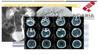 MANEJO INICIAL EN PACIENTES POLITRAUMATIZADOS
RADIOGRAFÍAS DE COLUMNA
TOMOGRAFÍA COMPUTARIZADA DE CRÁNEO, TÓRAX, ABDOMEN Y/O COLUMNA
UROGRAFÍA CON CONTRASTE
ANGIOGRAFÍA
RADIOGRAFÍA DE EXTREMIDADES
ECOGRAFÍA TRANSESOFÁGICA
BRONCOSCOPIA
ESOFAGOSCOPIA
 