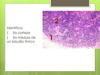 Identifica;
( )la corteza
( )la médula de
un lobulillo tímico
 