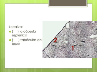 Localiza:
 ( ) la cápsula
esplénica
 ( )trabéculas del
bazo
 