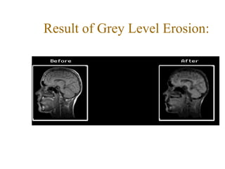Result of Grey Level Erosion:
 