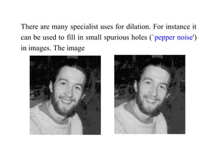 There are many specialist uses for dilation. For instance it
can be used to fill in small spurious holes (`pepper noise')
in images. The image
 