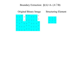 1 1
1
0
1 1
1 1 1
0
1 1 1 0 1 1 1 1 1
0
1
1
1
1 1
1
1 1 1
1
1
1 1 1
1 1
1 1 1
1
1
1 1 1
1 1
1 1 1
1
1 1 1
1 1 1
1 1 1
Original Binary Image Structuring Element
Boundary Extraction: β(A)=A- (A B)
 