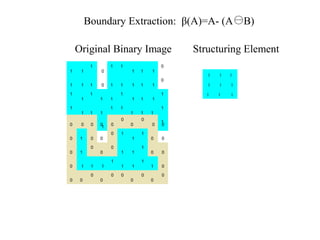 1 1
1
0
1 1
1 1 1
0
1 1 1 0 1 1 1 1 1
0
1
1
1
1 1
1
1 1 1
1
1
1 1 1
1 1
1 1 1
1
1
1 1 1
1 1
1 1 1
1
1 1 1
1 1 1
1 1 1
Original Binary Image Structuring Element
A B
Boundary Extraction: β(A)=A- (A B)
0 0 0 0 0
0
0
0
0 0
0 1 0 0
0 1
1
1
0 0
0 1
0
0
0
1 1
1
0 0
0 1 1 1
1
1 1
1
1 0
0 0
0
0
0 0
0
0
0
0
 